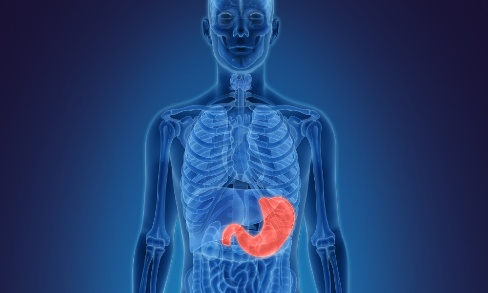 Click the video to learn about performance data for Mass General surgical procedures that treat conditions of the stomach